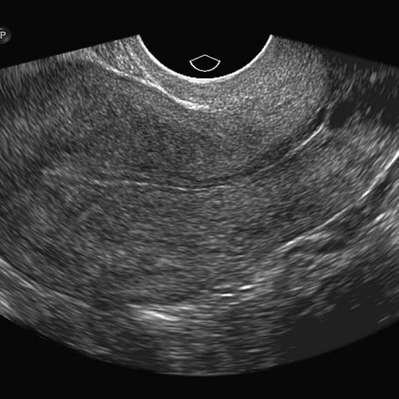 when is the most accurate dating ultrasound